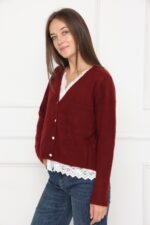 ⁦סריג תחרה⁩ – תמונה ⁦2⁩